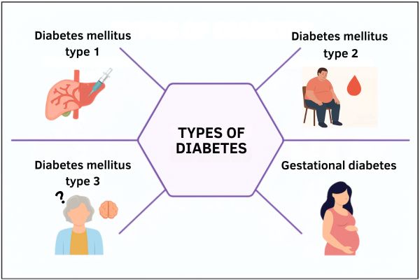 types of diabetes treated at Bombay Hospital in Mumbai.
