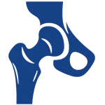 Osteoarthritis of the Hip