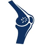 Knee Arthritis