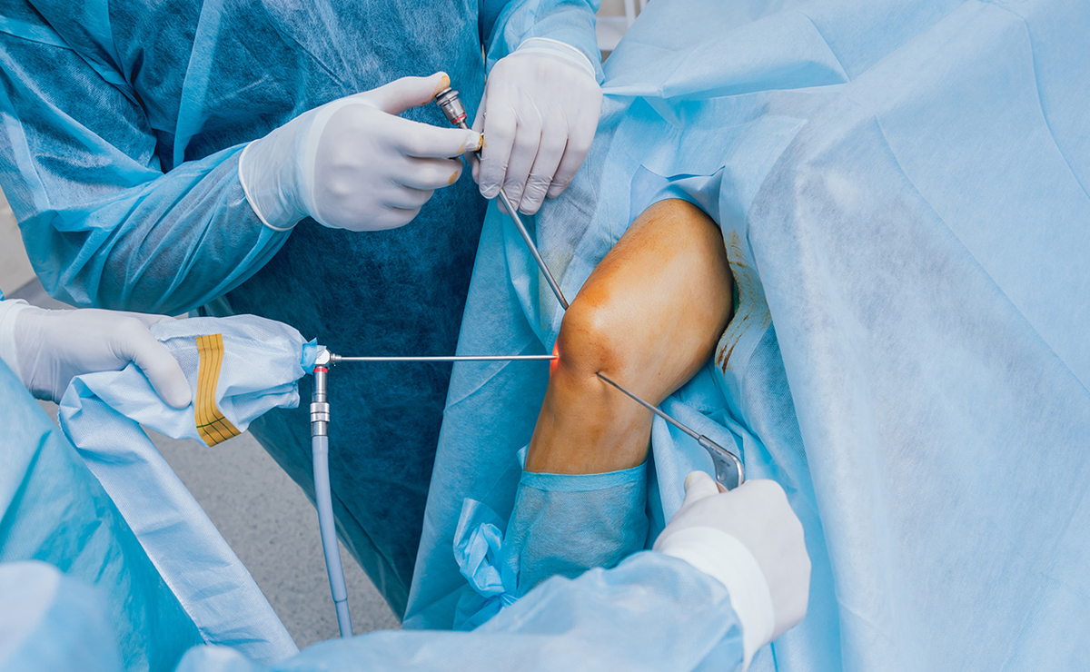 Advanced Knee Arthroscopy Surgery - Dr. Ameya Katariya