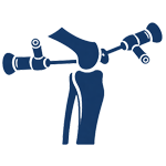 Knee Arthroscopy