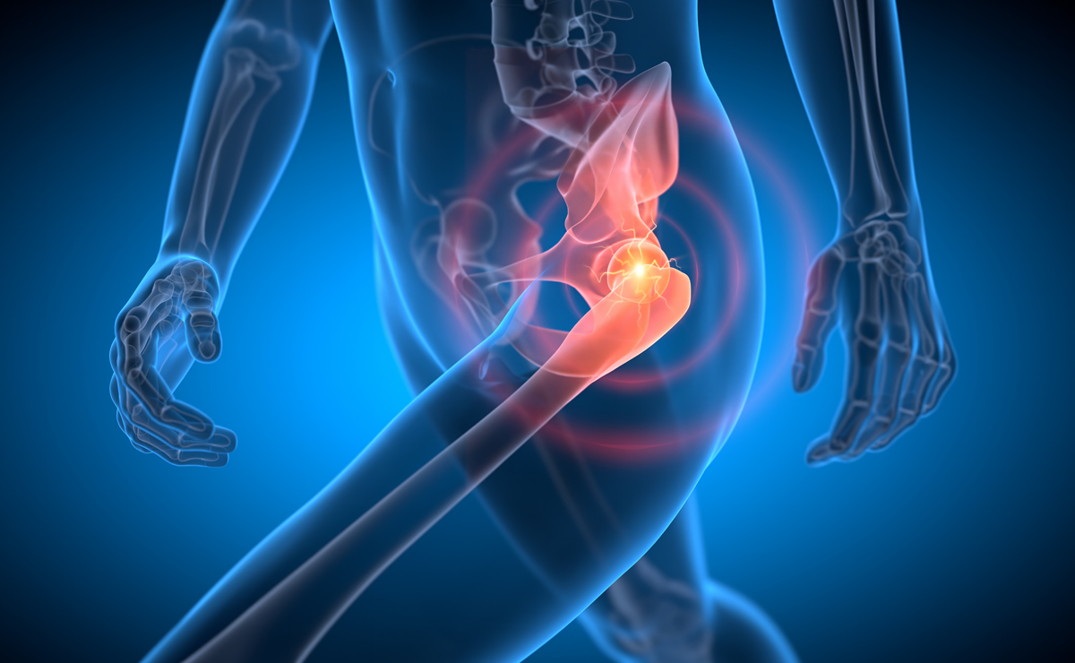 Osteoarthritis of the Hip Treatment - Dr. Ameya Katariya