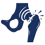 Total Hip Replacement