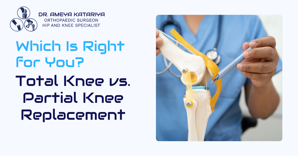 Total Knee vs. Partial Knee Replacement