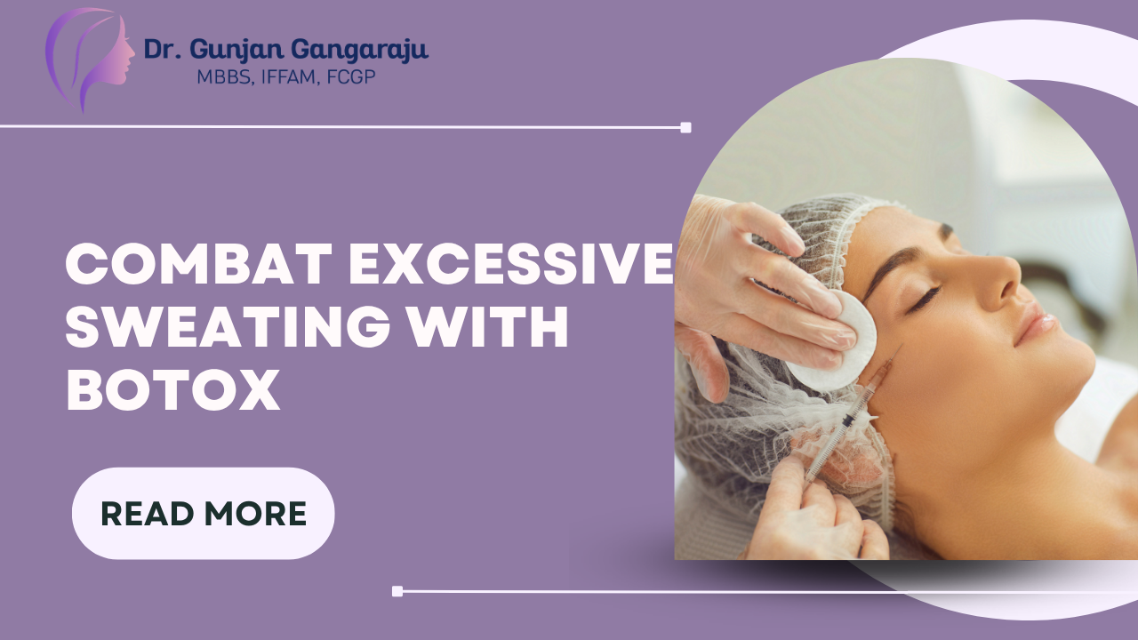 Combat Excessive Sweating with Botox: A Comprehensive Guide