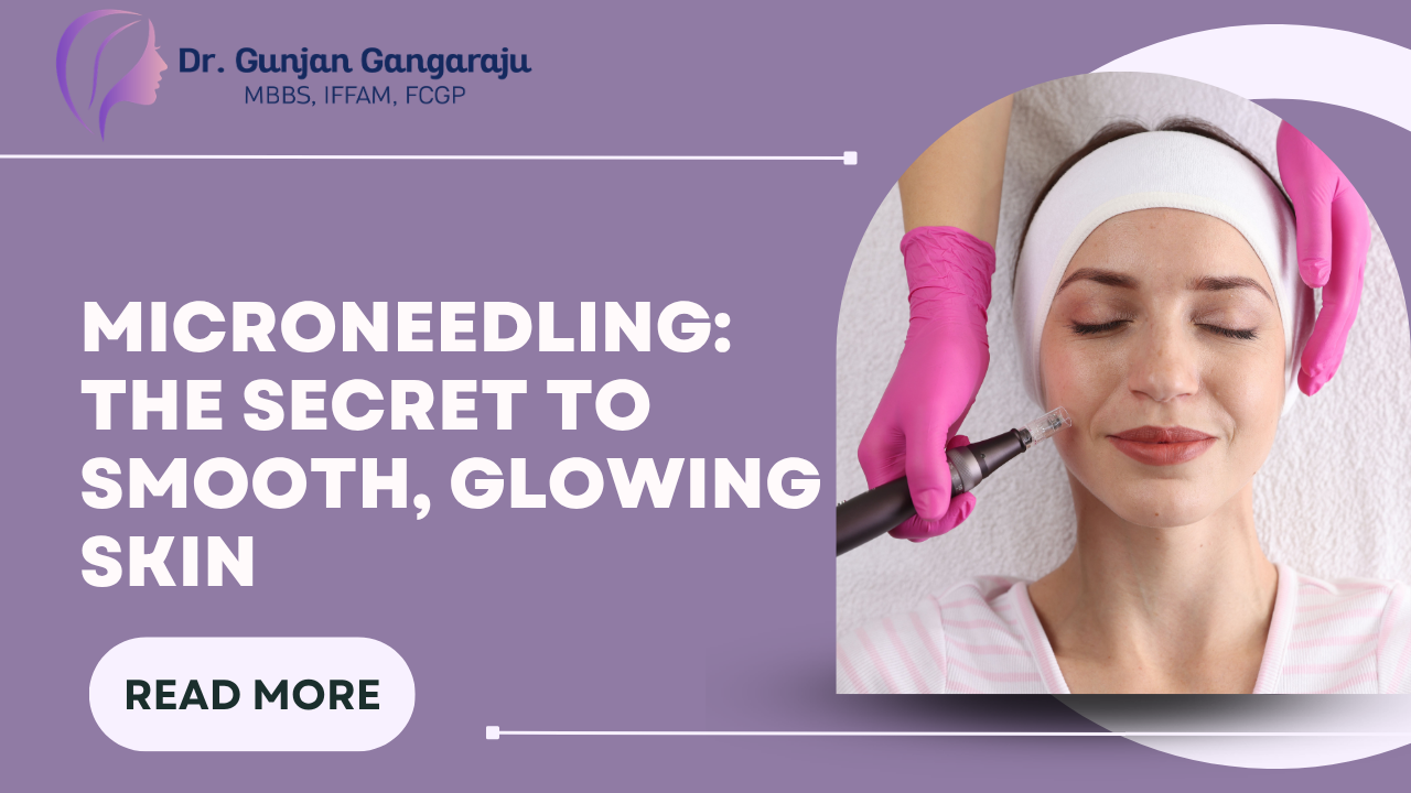 Microneedling: The Secret to Smooth, Glowing Skin