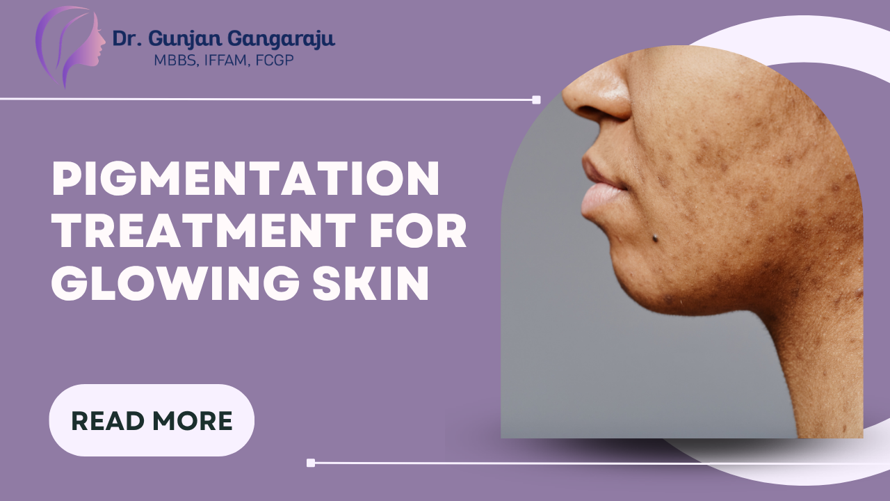 Pigmentation Treatment in Navi Mumbai | Glowing Skin
