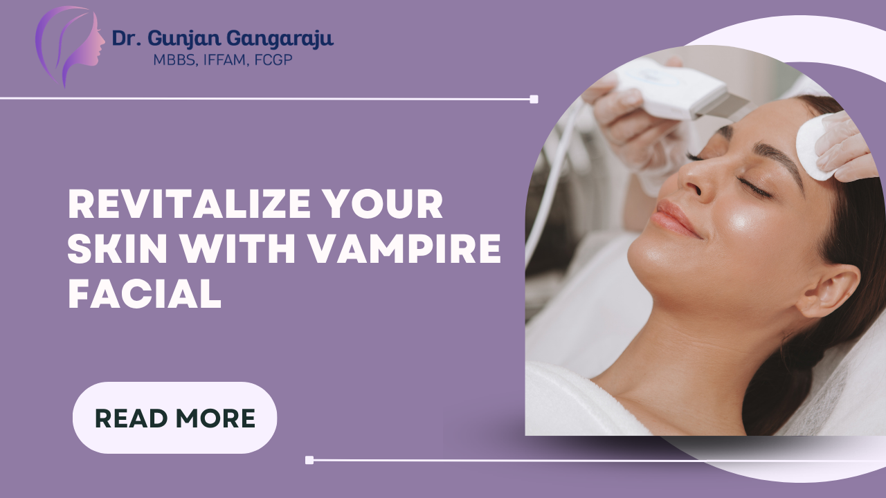 Revitalize Your Skin with Vampire Facial: What You Should Know