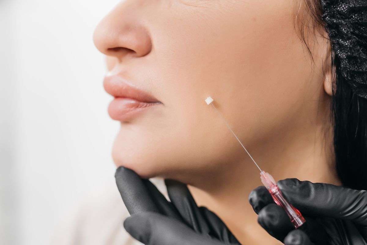 Thread Lift in Navi Mumbai | Non-Surgical Skin Tightening