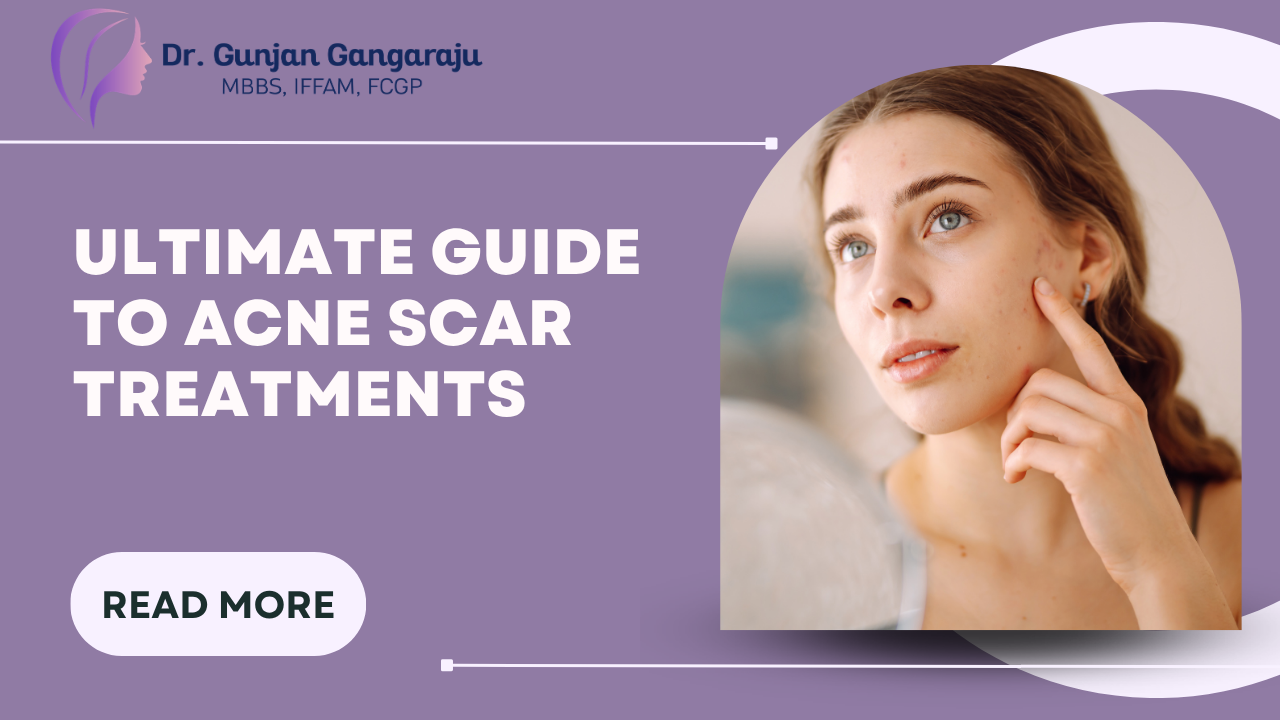 Ultimate Guide to Acne Scar Treatments in Navi Mumbai