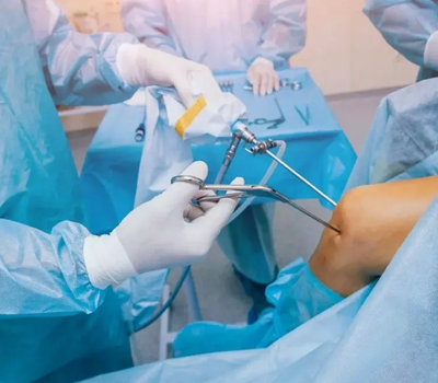 Arthroscopic Ligament Reconstruction