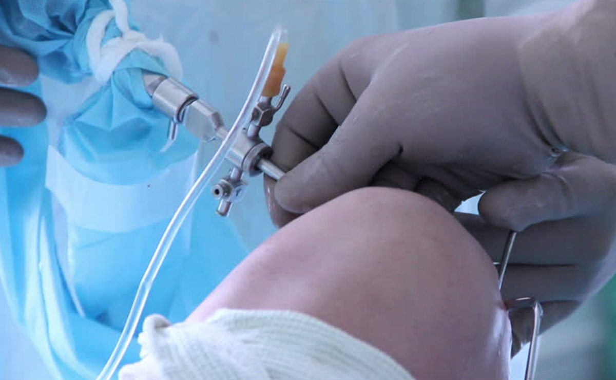 Expert Complex Trauma Surgeries in Pune - Dr. Sahil Lombar