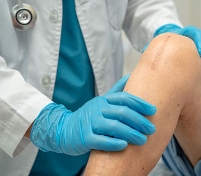 Knee Preservation Surgeries