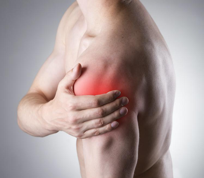 Recurrent Shoulder Dislocations