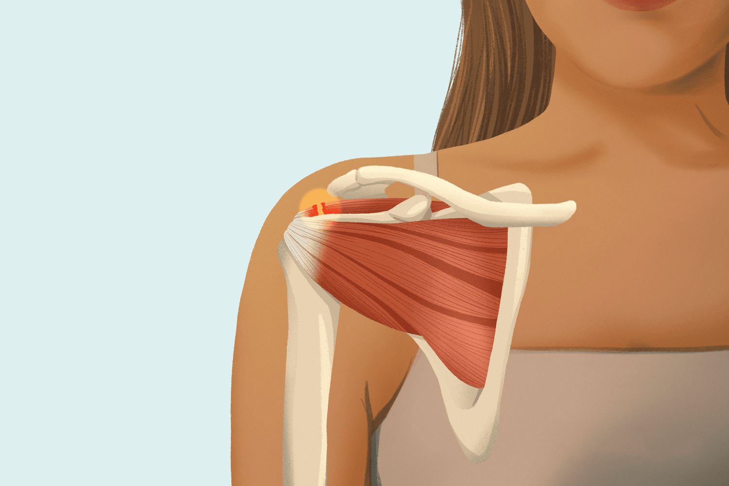 Rotator Cuff Injury Treatment and Shoulder Surgery in Pune - Dr. Sahil Lombar