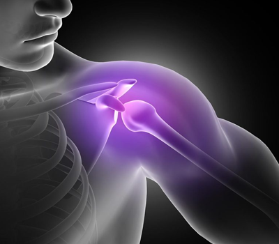 Rotator Cuff Injury
