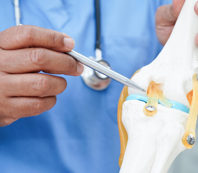 Total Knee Replacement