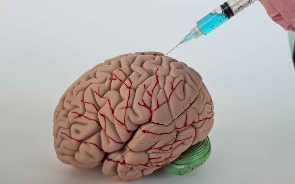 Cerebrovascular Surgery