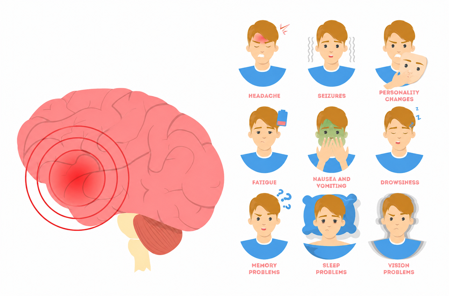 Brain MRI Scan Detail