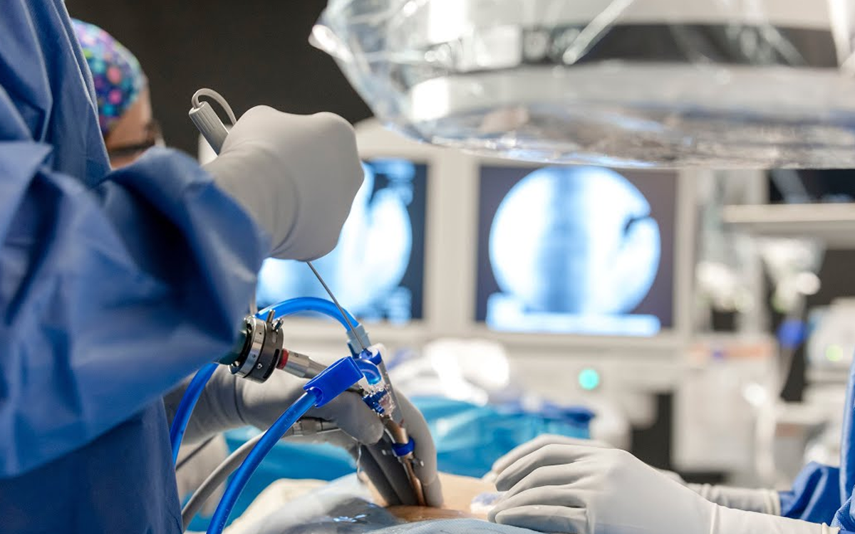 Endoscopic Spinal Surgery