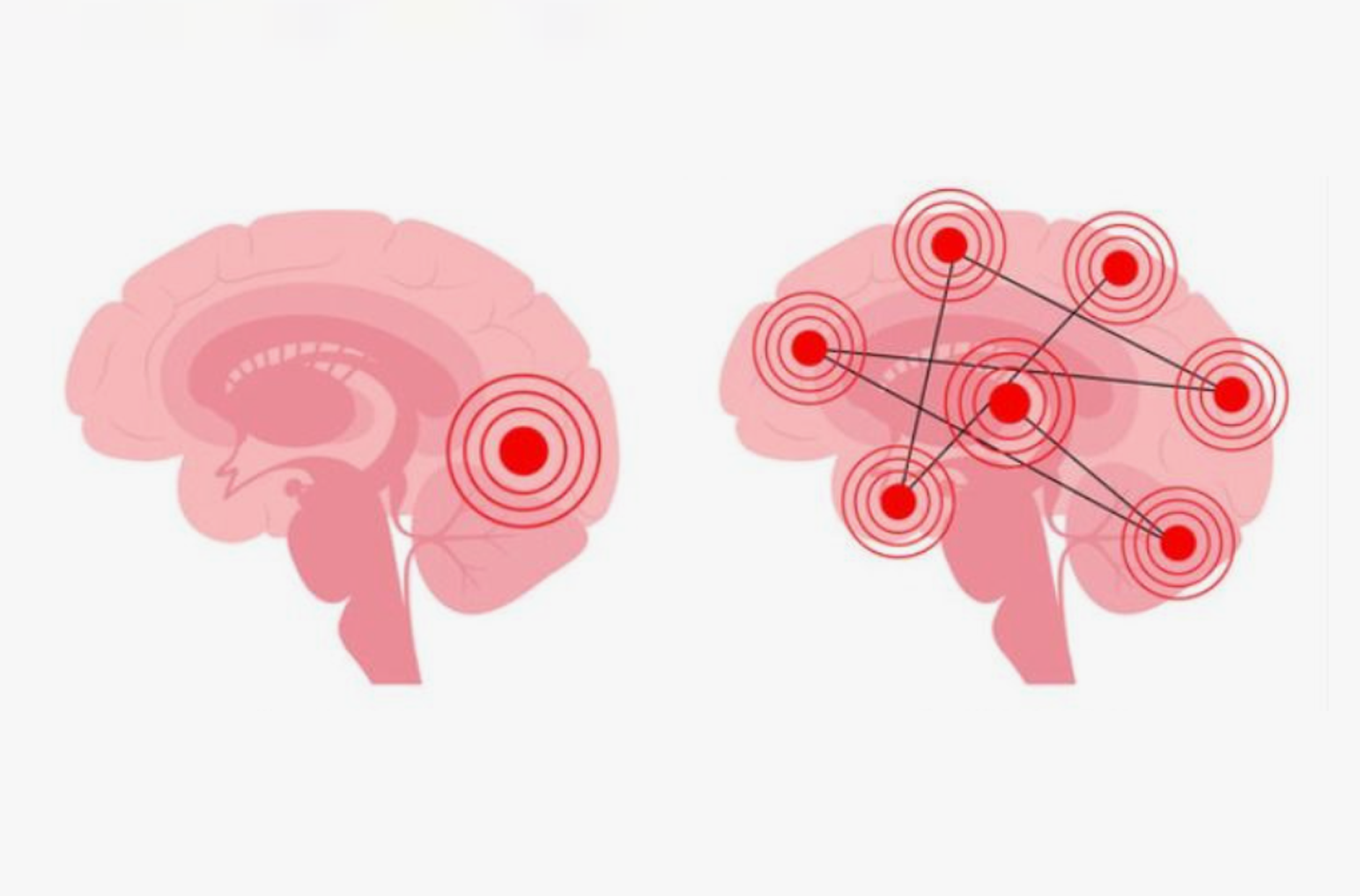 Patient in Video-EEG monitoring unit