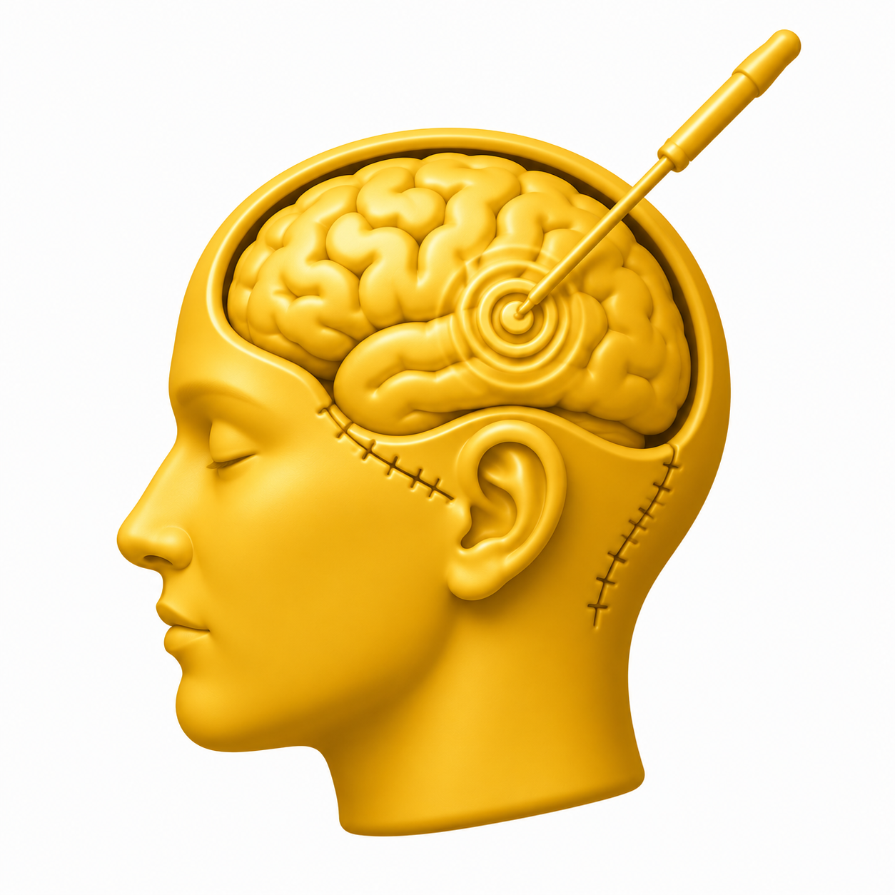 Epilepsy Surgery