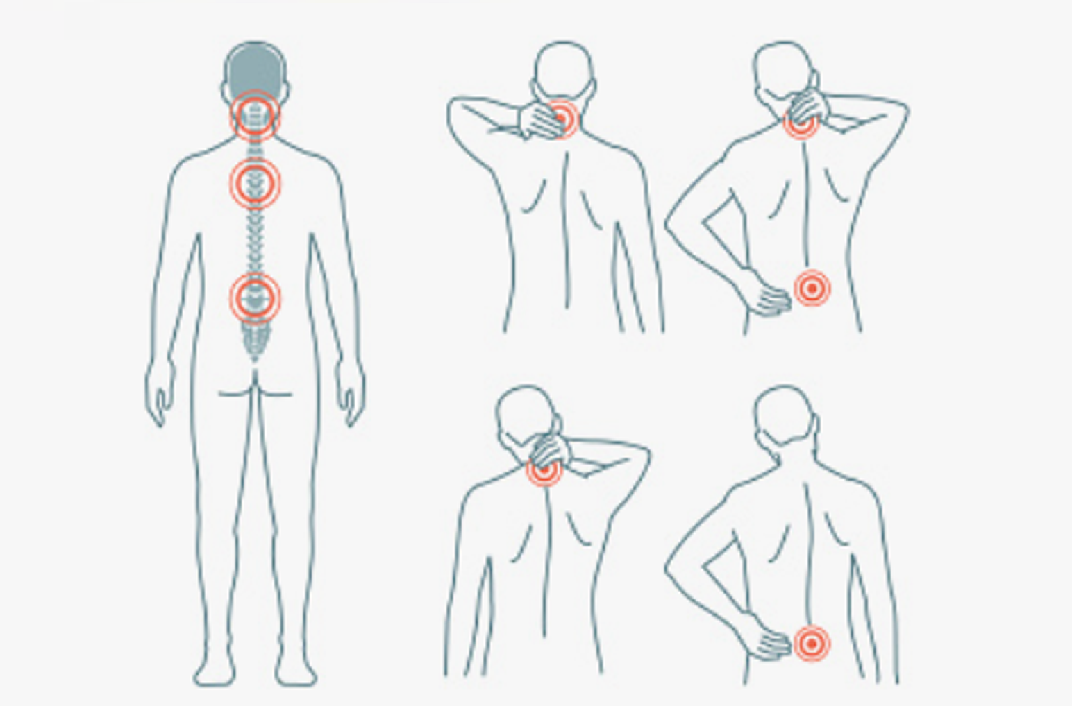 Back pain anatomy visualization