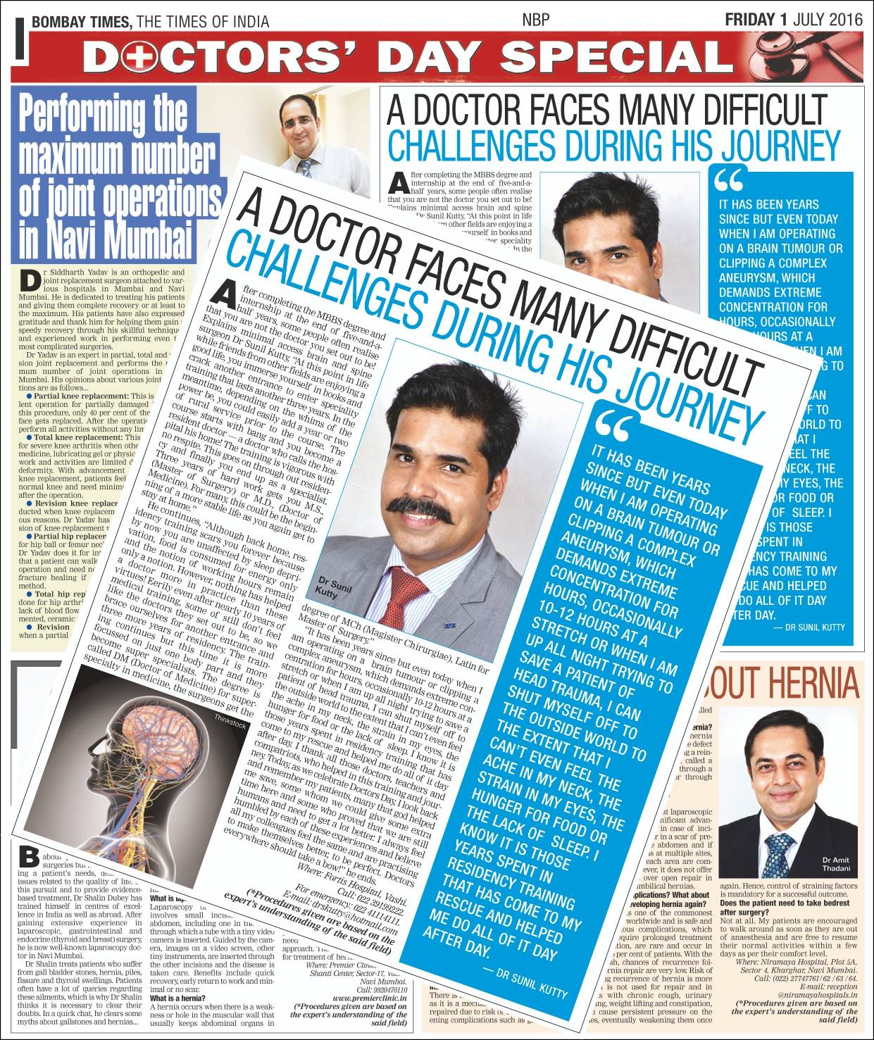 Epilepsy Surgery