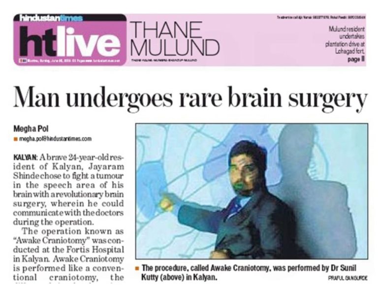 Epilepsy Surgery