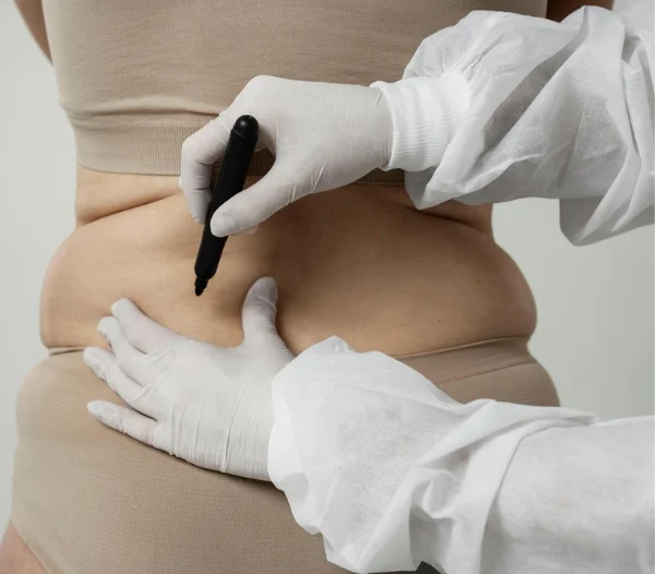 Perineal Body Reconstruction