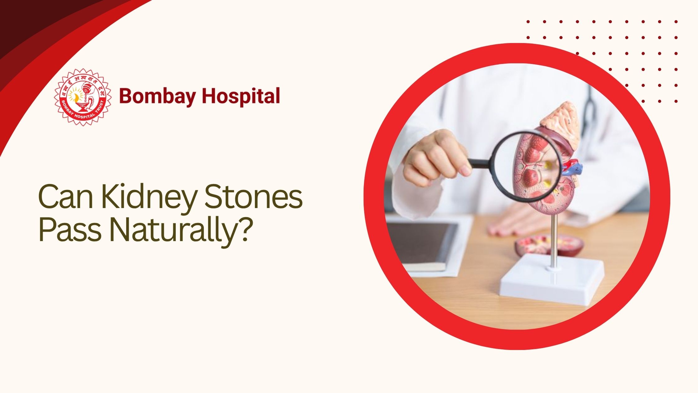 Can Kidney Stones Pass Naturally?
