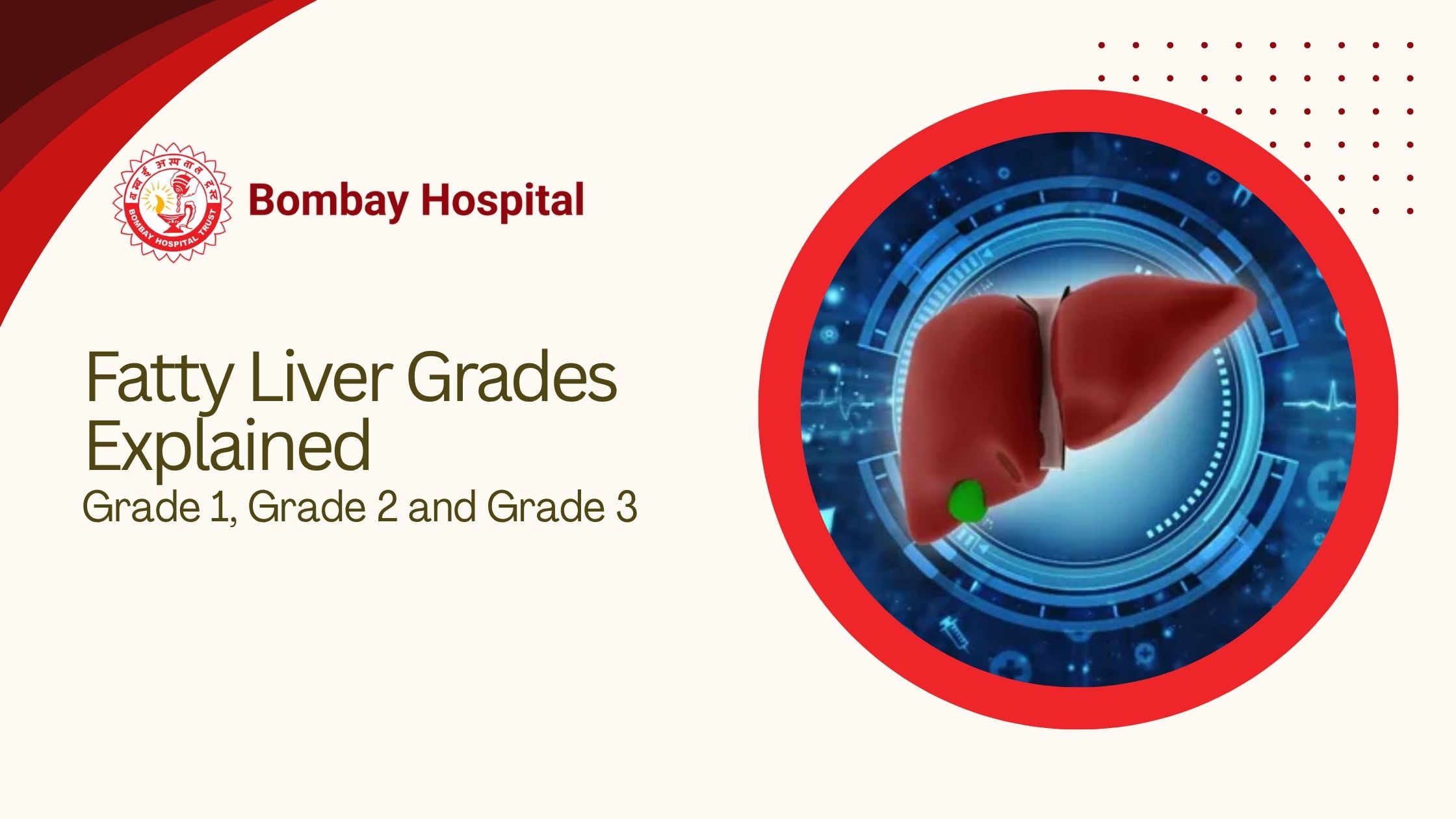 Fatty Liver Grades Explained: Grade 1, Grade 2 and Grade 3