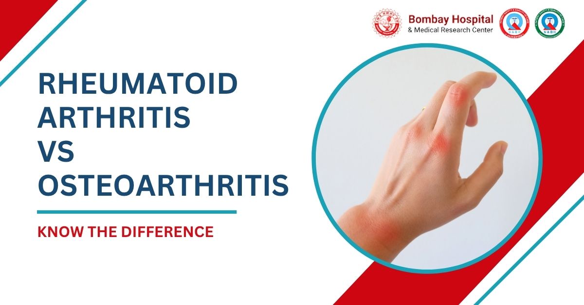 Rheumatoid Arthritis vs Osteoarthritis: What Is the Difference?