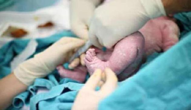 3 साल में हुई बच्चे की डिलवरी, देखने वालों के उड़े होश 3 साल में हुई बच्चे की डिलवरी, देखने वालों के उड़े होश