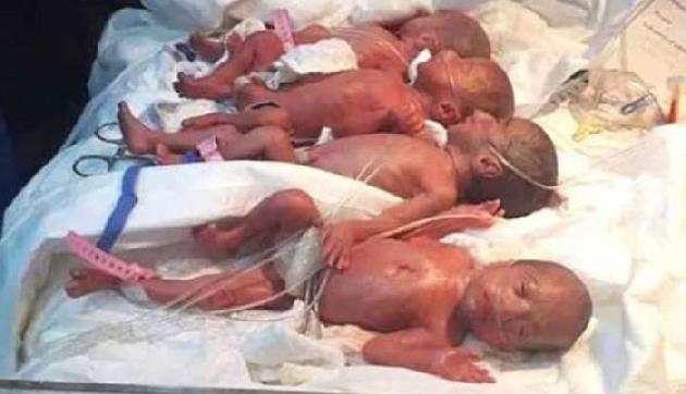 OMG: 25 साल की महिला ने दिया एक साथ 7 बच्चों को जन्म OMG: 25 साल की महिला ने दिया एक साथ 7 बच्चों को जन्म