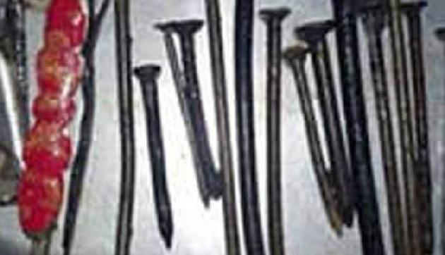 इस शख्स को थी लोहा खाने की आदत, Doctar ने पेट से निकाली 116 कीलें इस शख्स को थी लोहा खाने की आदत, Doctar ने पेट से निकाली 116 कीलें