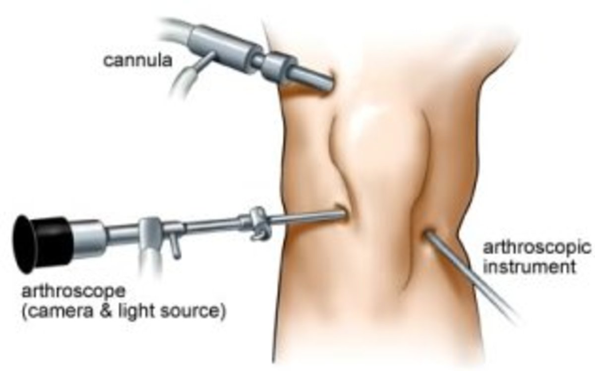 Arthroscope.jpg Arthroscope.jpg