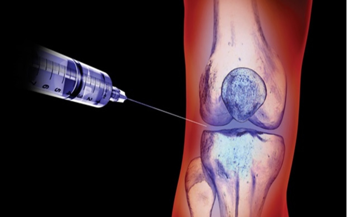 Knee injection logo.jpg Knee injection logo.jpg