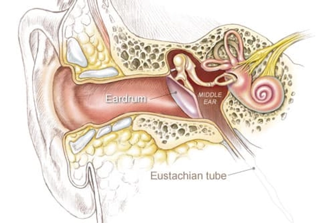 Ear Infection