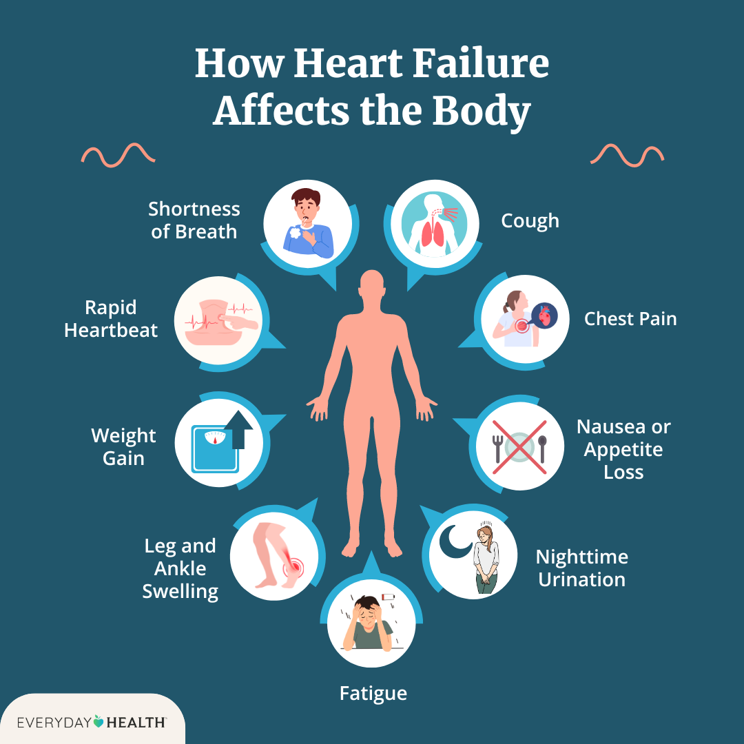 Causes of Heart Failure