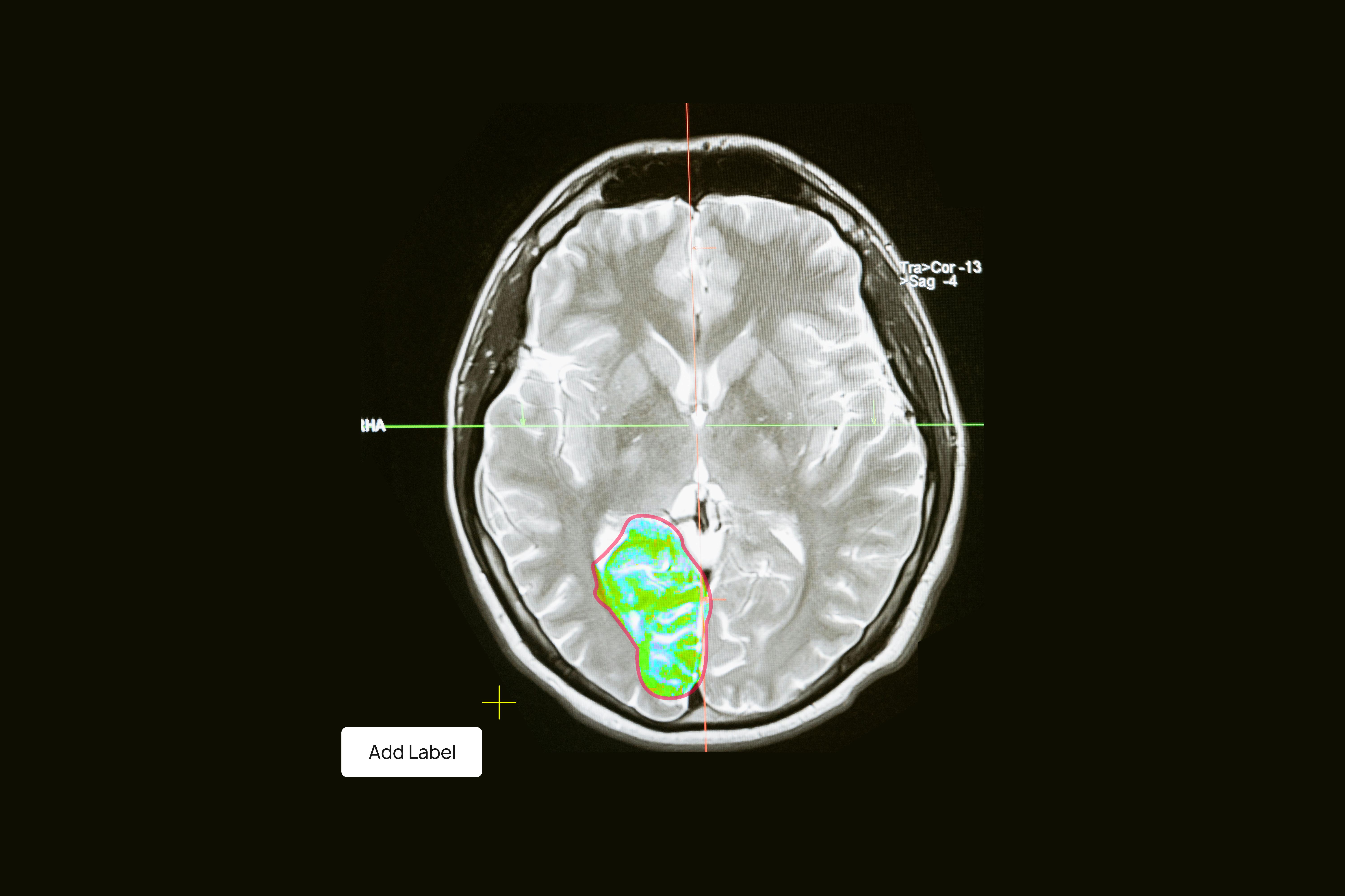 Polygon Annotation