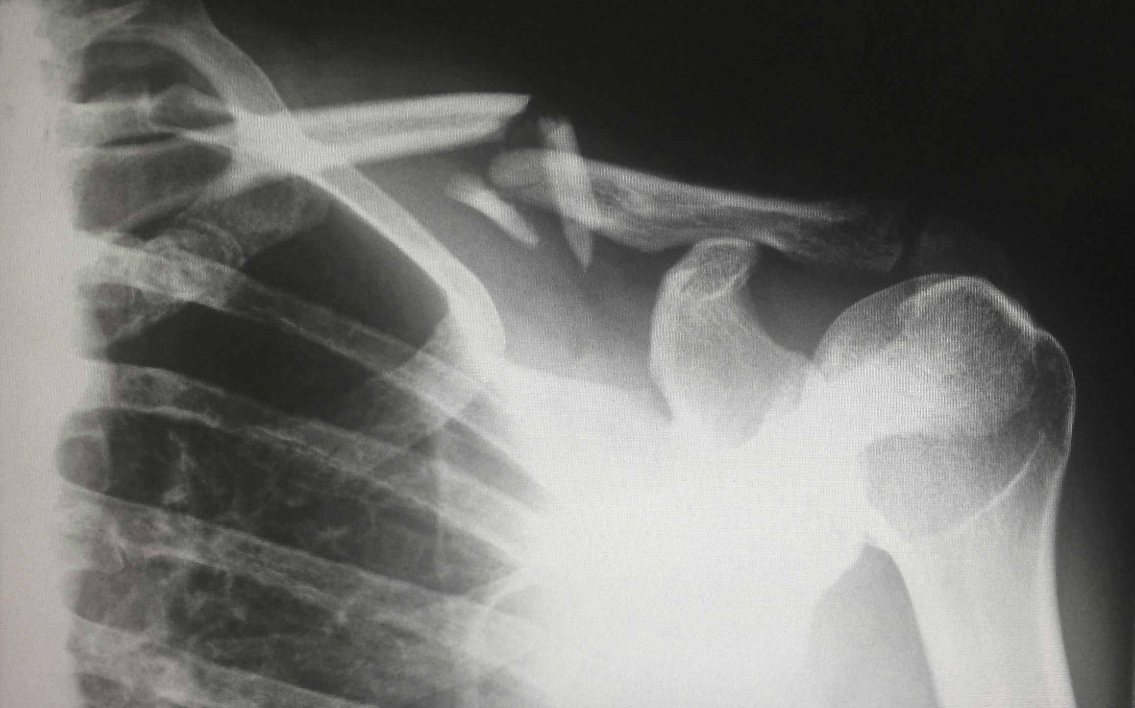 Steps Involved in Filing a Medical Malpractice Claim