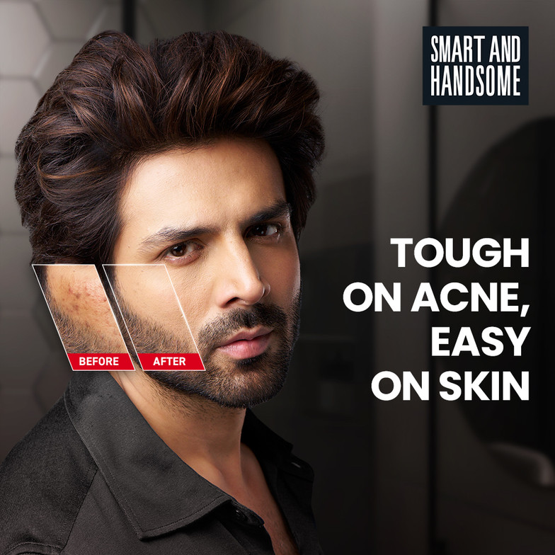 Smart and Handsome Acnefix Xpert  | Anti-Acne, Non-Irritant Formula Face Wash 150g
