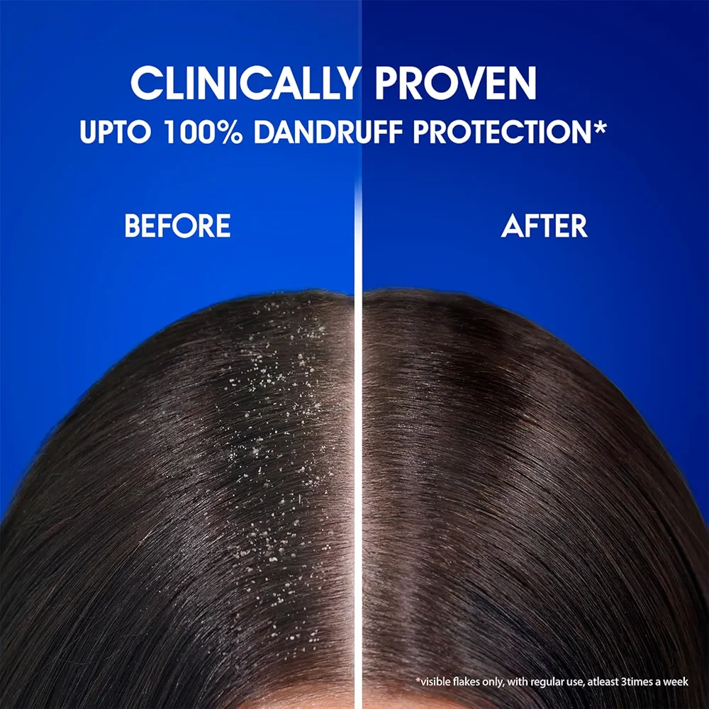 Head & Shoulders , Anti Dandruff Shampoo, Smooth & Silky, 180 ML, White