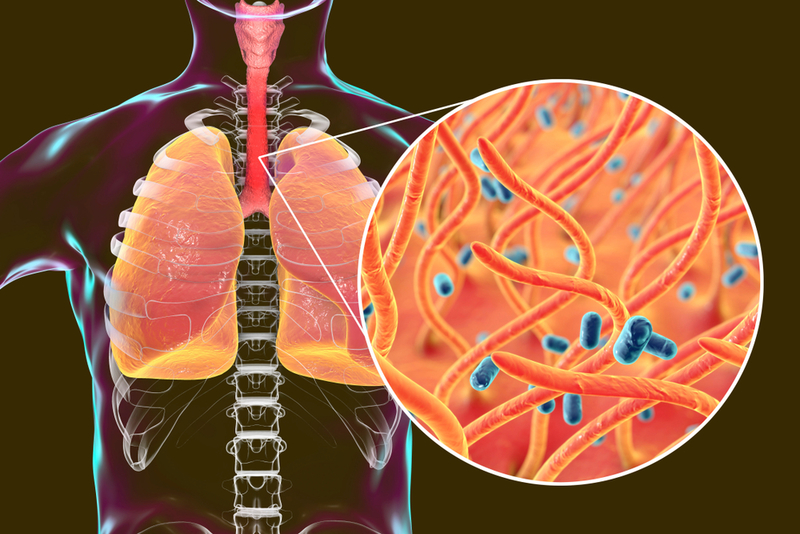 pertussis cause diagram wiring block diagram Bordetella Pertussis pertussis, a highly contagious disease of respiratory tract pertussis pathophysiology pertussis cause diagram