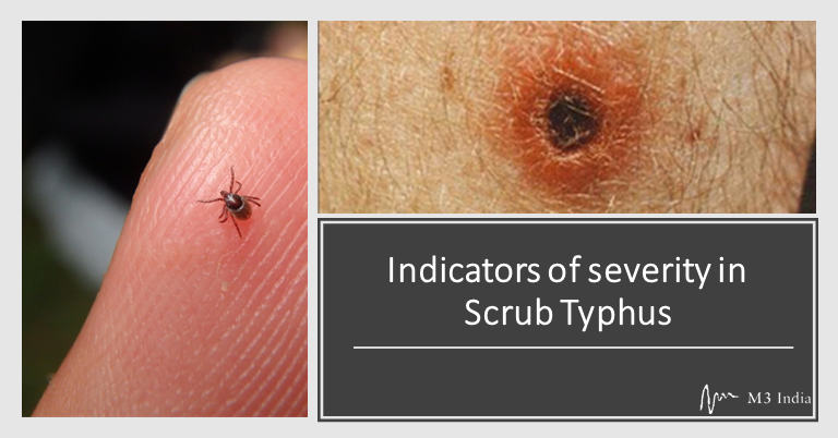 scrub-typhus-signs-and-symptoms-diagnosis-examination-treatment