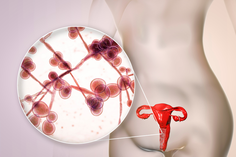 Idsa Guidelines Candida Uti