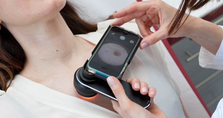 Skin Cancer Diagnosis Apps Are Unreliable And Poorly Regulated Study S