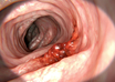 colon