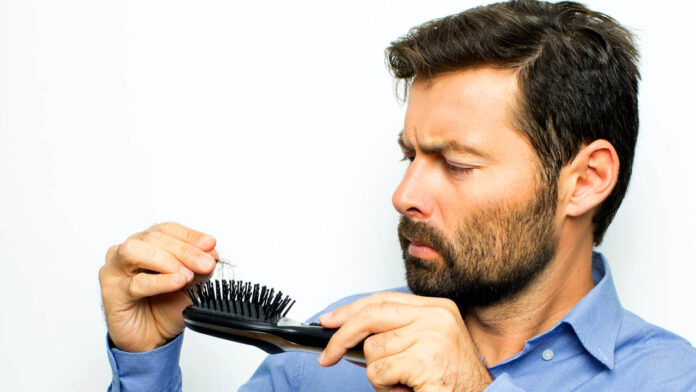 Hair Loss
